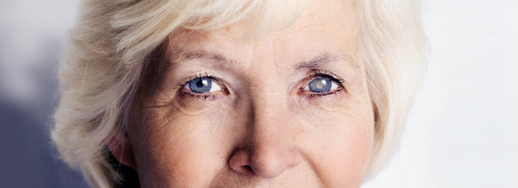 Cataract Surgery in Heritage Center
